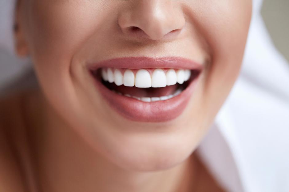 Ljuskice za zube | Autor: Shutterstock