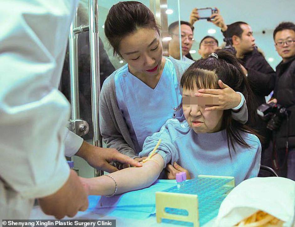  | Autor: Bolnica za plastičnu kirurgiju Sunline u Shenyuangu