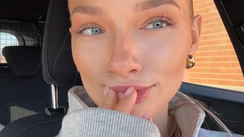 "Lip Basting" je TikTok beauty trik koji &cacute;e svaki put rije&scaron;iti tvoj problem suhih usana