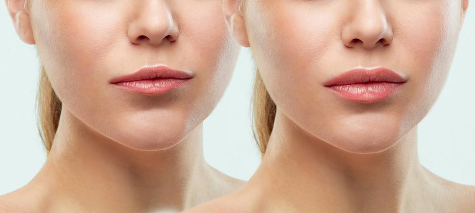 Fileri za usne / lip fileri | Autor: Shutterstock