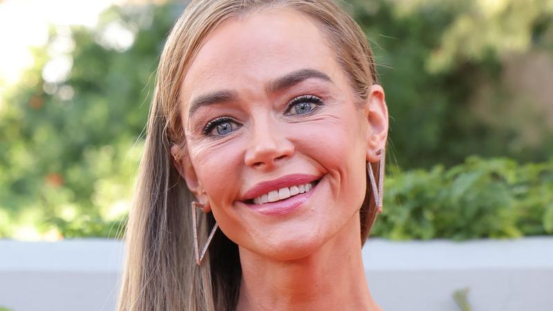 Prije i poslije: glumica Denise Richards ne skriva da je napravila facelifting. Dapa&ccaron;e, ponosna je rezultatom!