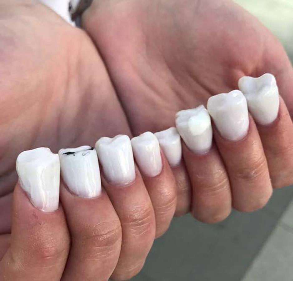 Uz stručnu manikuru ovi nokti izgledaju poput zubi | Autor: Instagram/@nail_sunny
