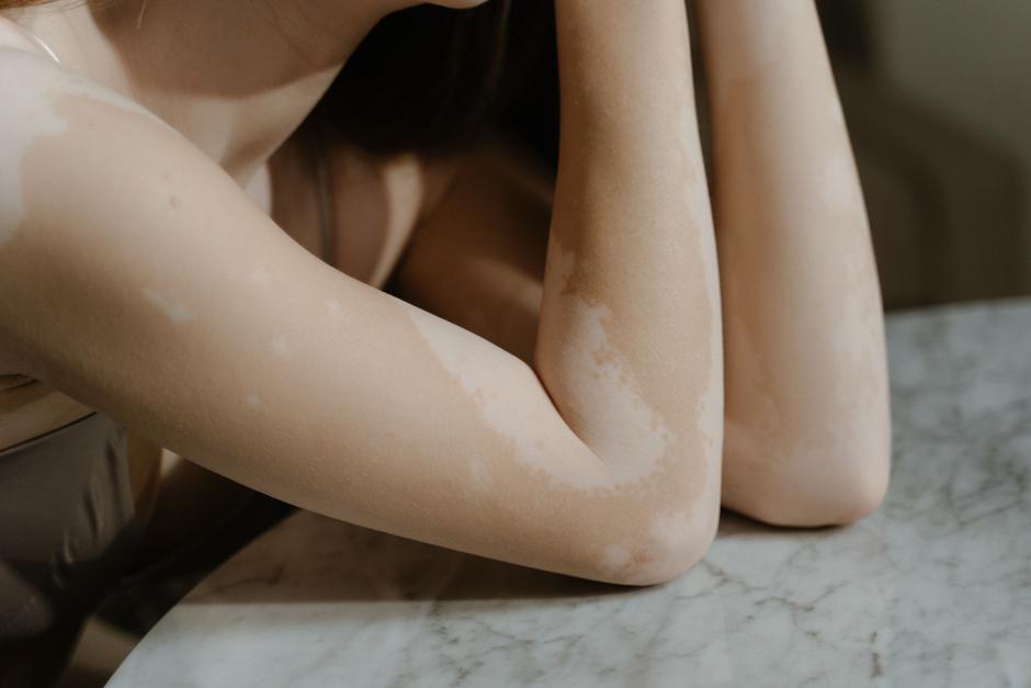  | Autor: Pexels/Ron Lach